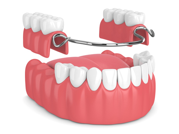 Denture